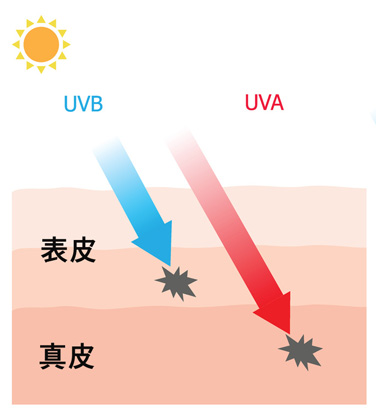 紫外線の害の画像