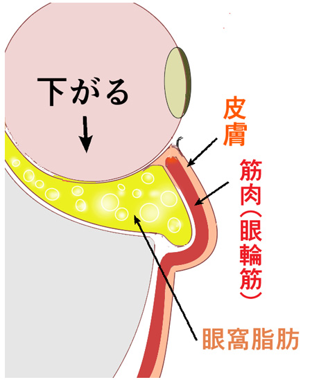 目の下のたるみがなぜできるか説明した画像