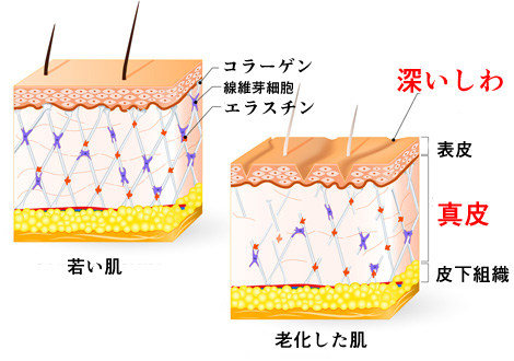 若い肌と老化した肌の比較