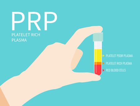 ＰＲＰ療法のイメージ図