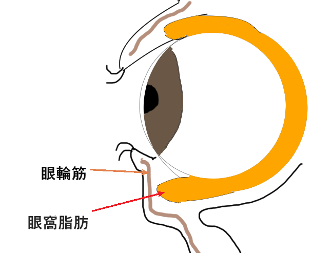 目の下のたるみの施術の説明図1