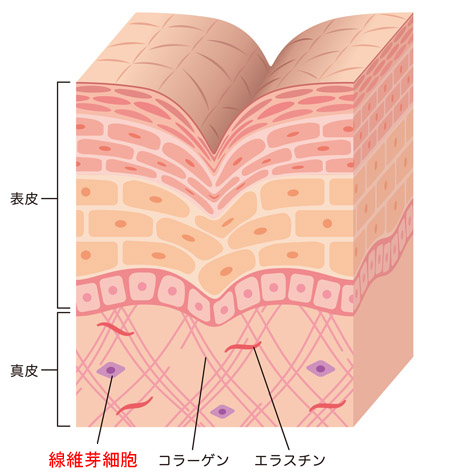シワの断面図の画像