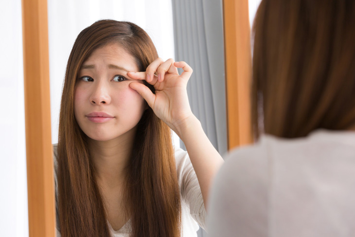 上まぶたのたるみに悩む女性の画像