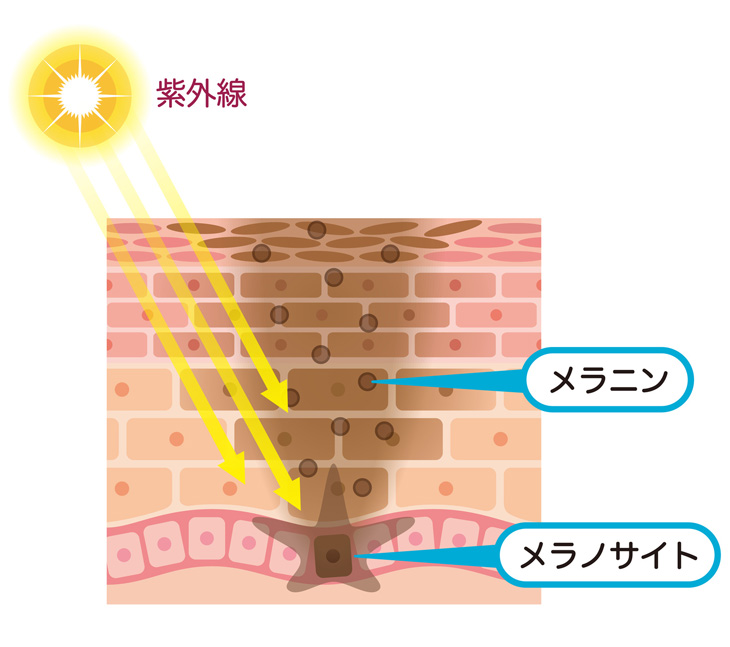 茶クマができるメカニズムの説明画像