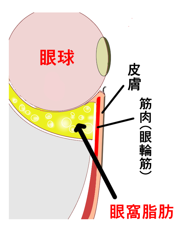 眼窩脂肪の画像