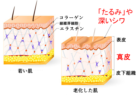 肌の老化の画像