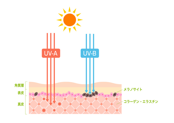 紫外線ダメージの画像