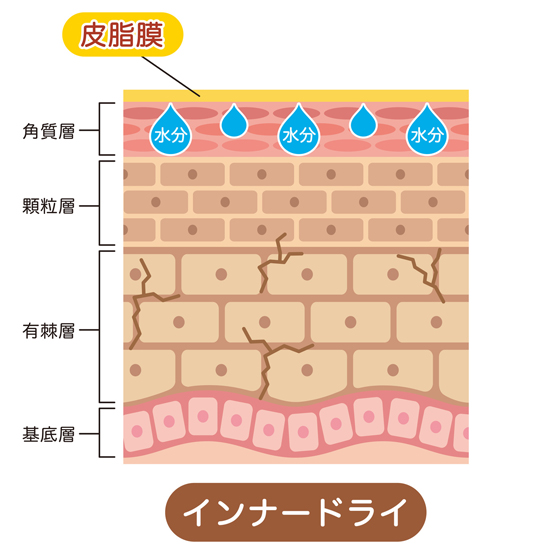 顔がヒリヒリする原因の説明画像