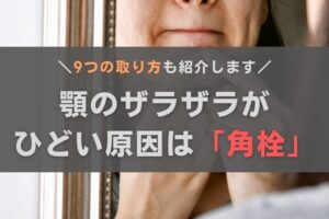 顎のザラザラはひどい角栓が原因！9つの取り方をおきゃんママが徹底解説