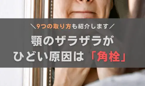 顎のザラザラはひどい角栓が原因！9つの取り方をおきゃんママが徹底解説